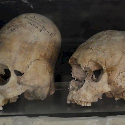 Afrosiab, Deformed skulls