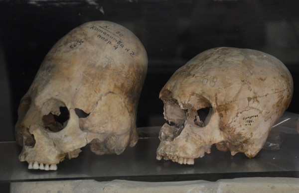 Afrosiab, Deformed skulls