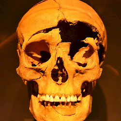 Regensburg-Harting, Skull