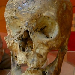 Gordium, Great Tumulus, Skull of the deceased
