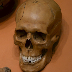 Velsen, Man in the well, skull